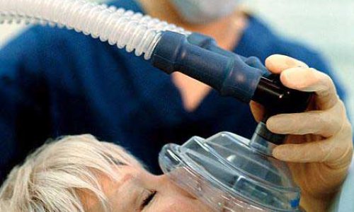 کاربرد گاز انتونوکس و نیتروس اکساید در پزشکی